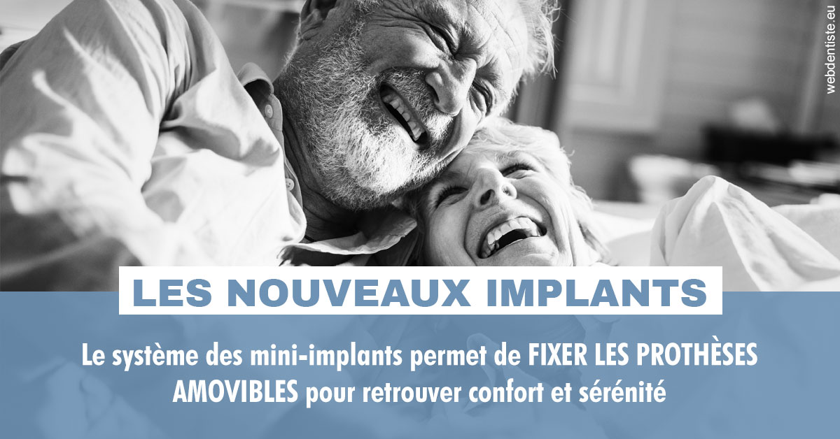 https://dr-bord-julien.chirurgiens-dentistes.fr/Les nouveaux implants 2