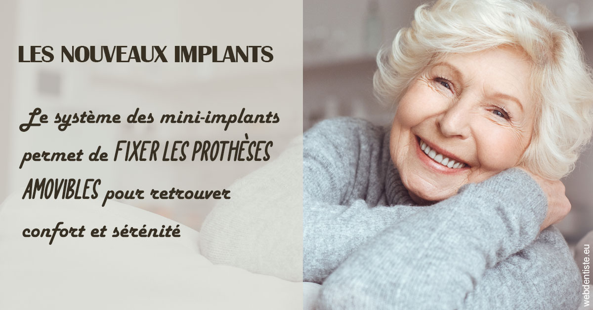 https://dr-bord-julien.chirurgiens-dentistes.fr/Les nouveaux implants 1