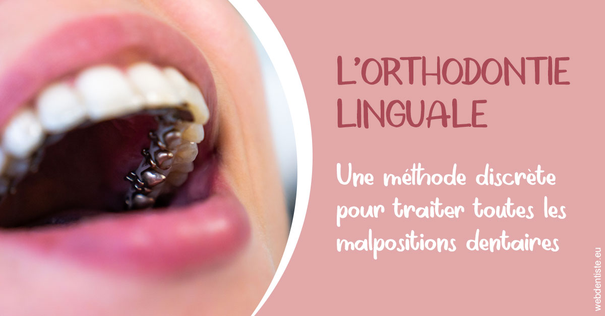 https://dr-bord-julien.chirurgiens-dentistes.fr/L'orthodontie linguale 2