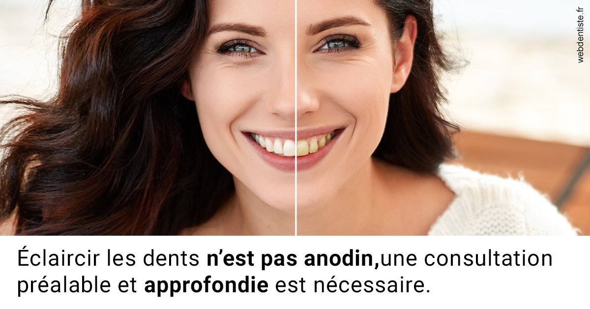 https://dr-bord-julien.chirurgiens-dentistes.fr/Le blanchiment 2