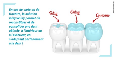 https://dr-bord-julien.chirurgiens-dentistes.fr/L'INLAY ou l'ONLAY