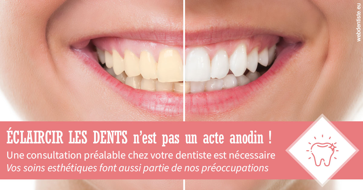 https://dr-bord-julien.chirurgiens-dentistes.fr/Eclaircir les dents 1