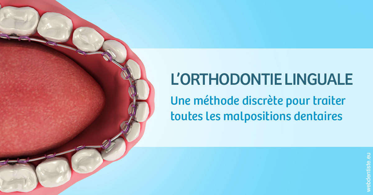 https://dr-bord-julien.chirurgiens-dentistes.fr/L'orthodontie linguale 1