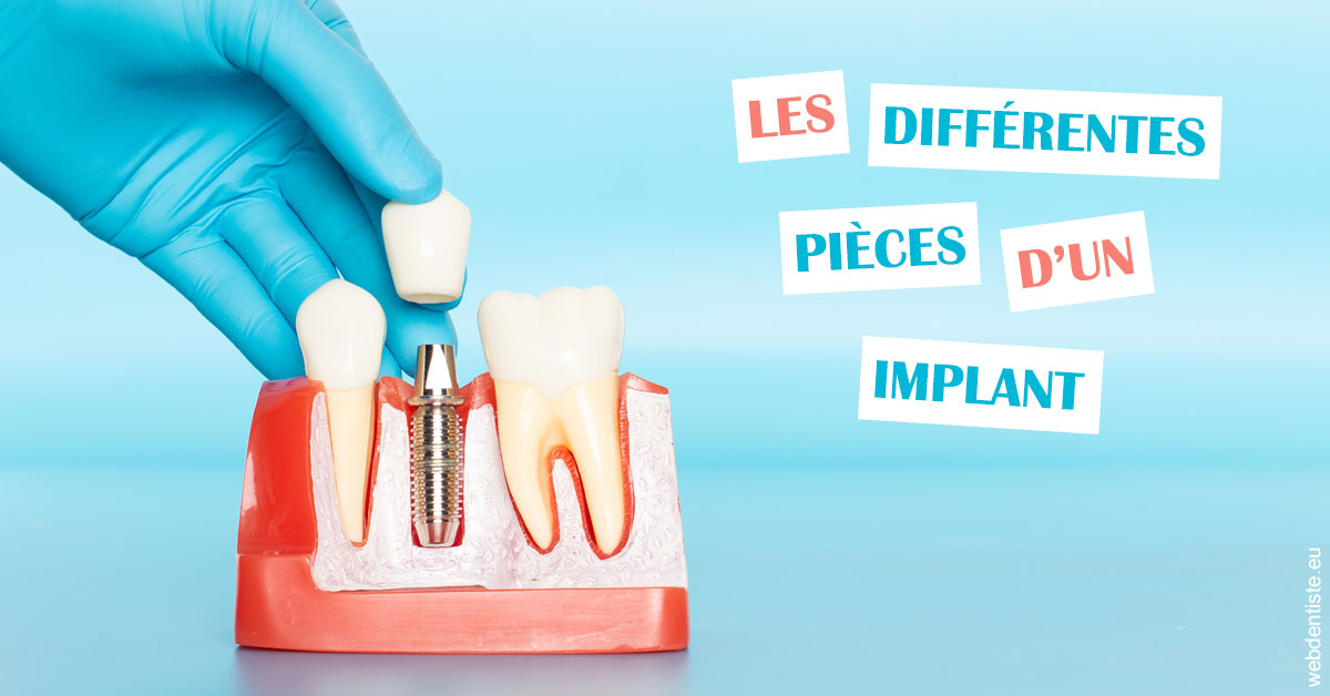 https://dr-bord-julien.chirurgiens-dentistes.fr/Les différentes pièces d’un implant 2