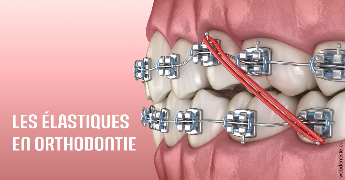 https://dr-bord-julien.chirurgiens-dentistes.fr/Elastiques orthodontie 2