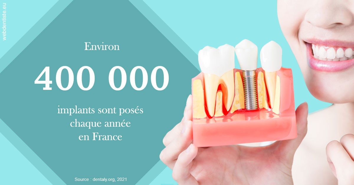 https://dr-bord-julien.chirurgiens-dentistes.fr/Pose d'implants en France 2
